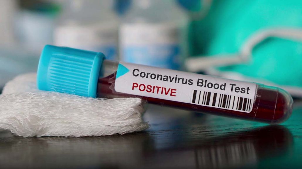 COVID19: 5 more tested positive in Nagaland; Total tally rises to 9