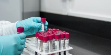 Covid-19 testing centers in Nagaland and know about different types of tests