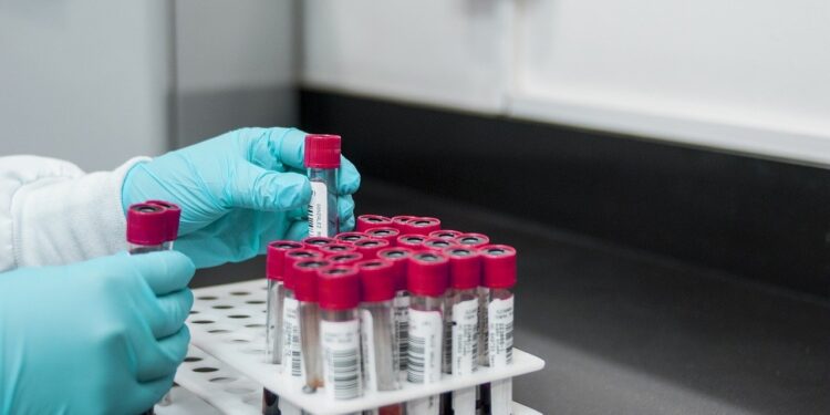 Covid-19 testing centers in Nagaland and know about different types of tests